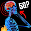 5G!
